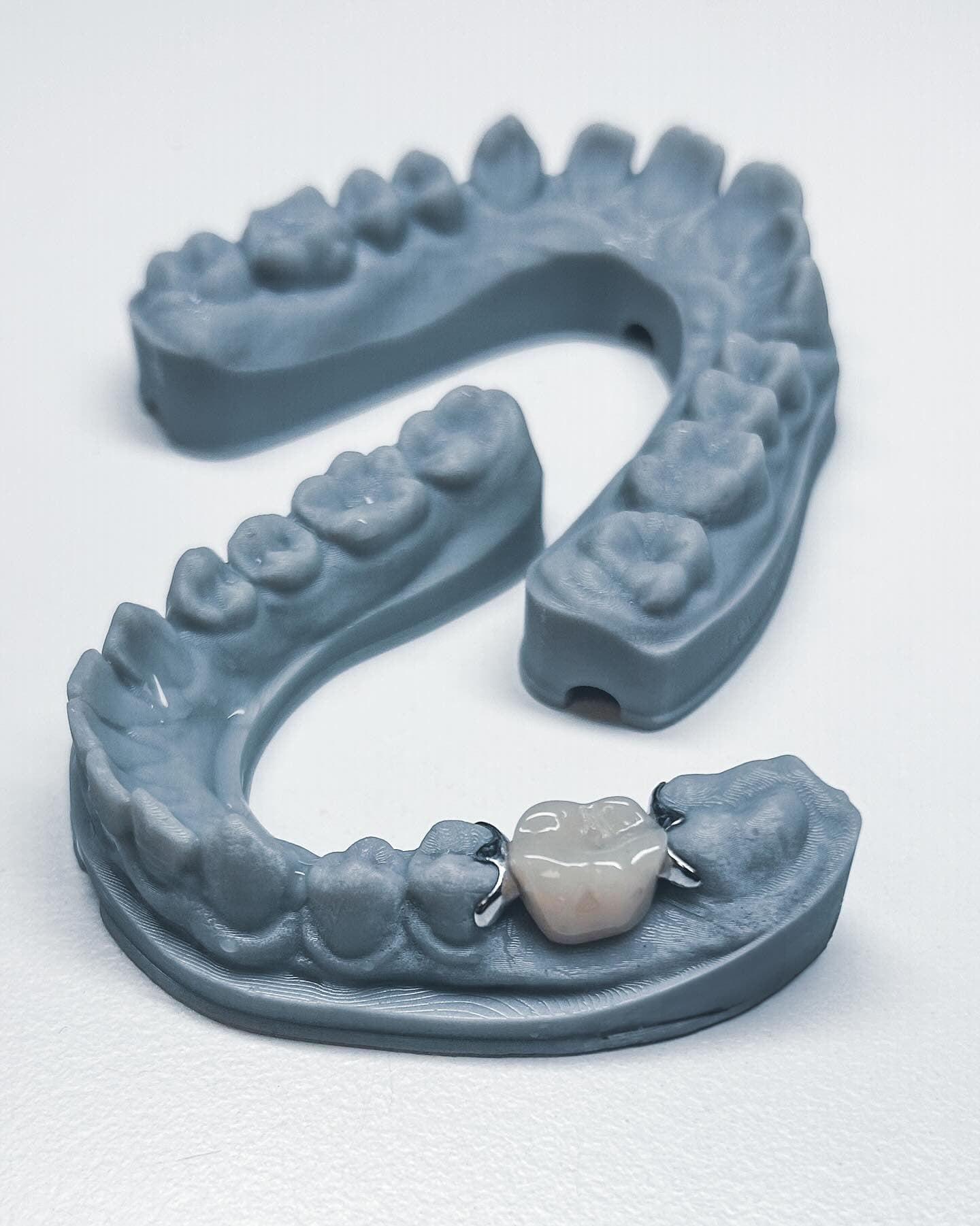 3D printed upper and lower dental arch models showing digital scanning precision