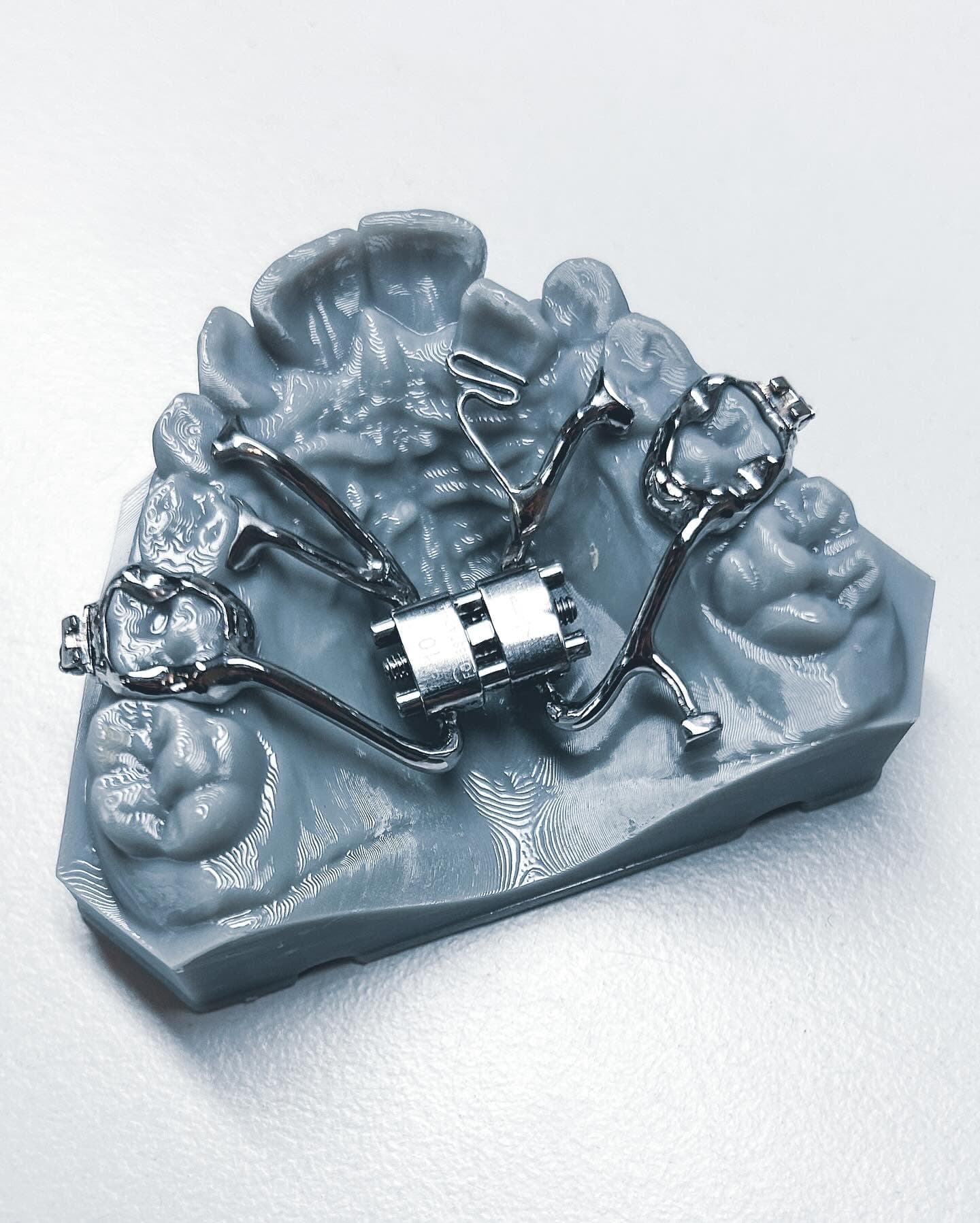 Precision orthodontic appliance by Nordicdens