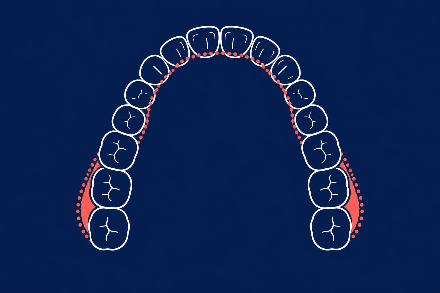 Intraoral Scan Errors in Orthodontics: Causes and Fixes
