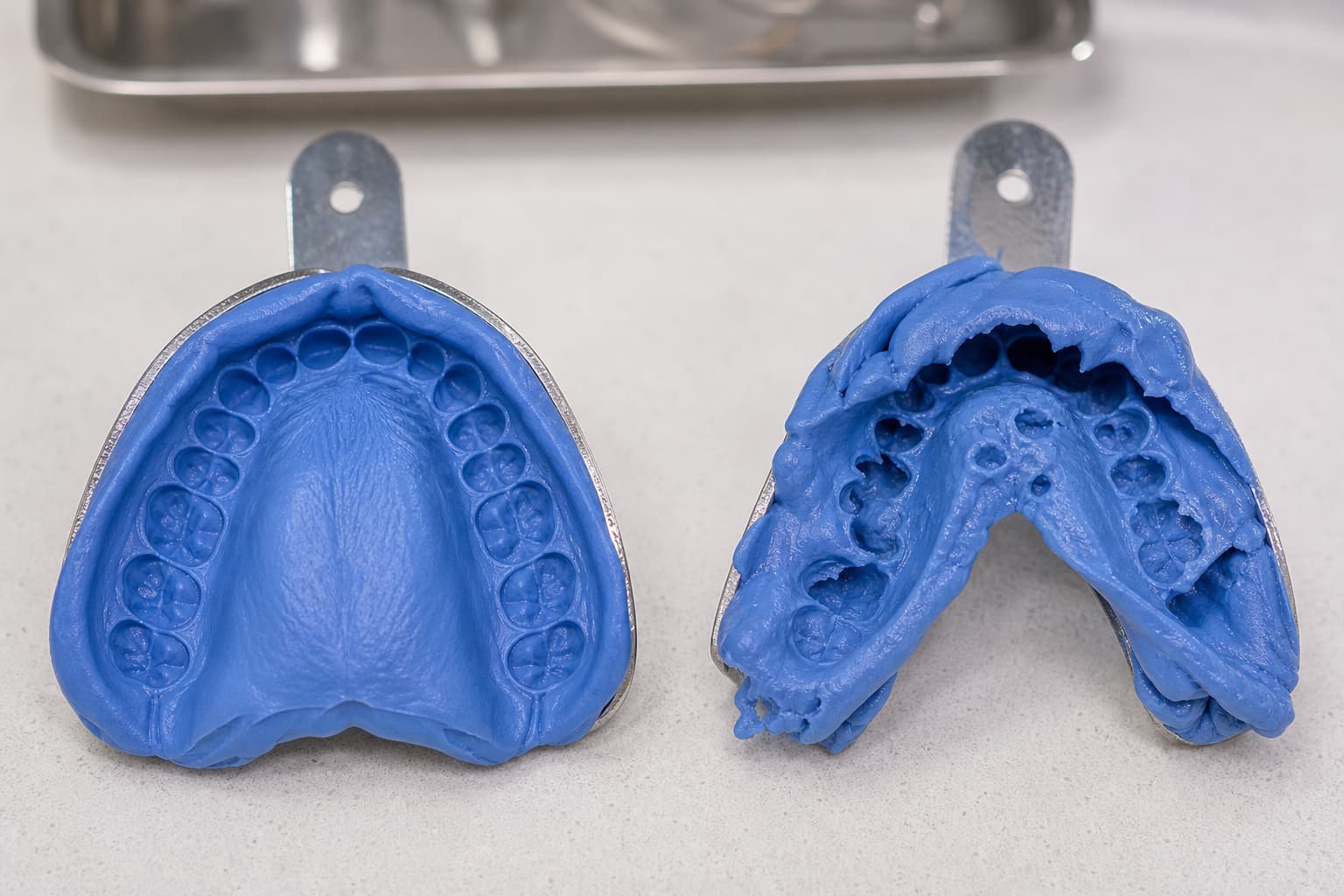 Why Orthodontic Lab Cases Get Rejected (and How to Fix It)